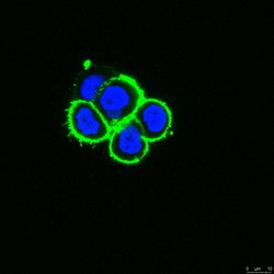 ADAM 12, Mouse anti-Human, Clone: 6E6, Millipore Sigma:Antibodies:Primary